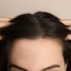 Why Does My Hairline Curl Up?